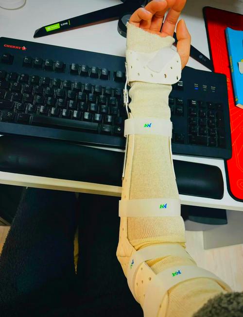 tfcc损伤康复日记:短臂支具的奇妙效果