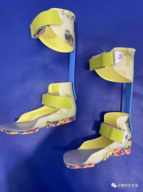 dmd/sma患儿的康复辅具系列产品介绍:包含矫正鞋,矫形器,定制轮椅和