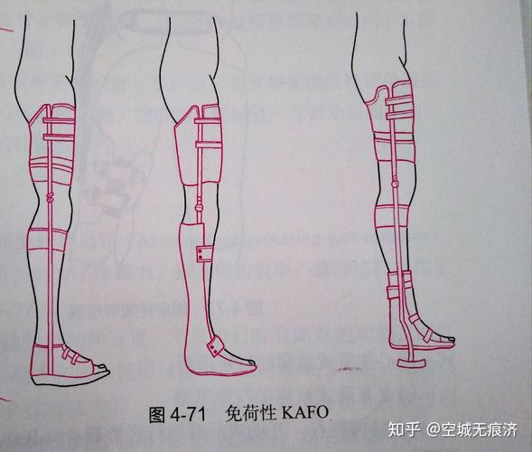 临床康复工程学假肢与矫形器24&bull;