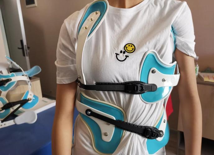 脊柱侧弯治疗所需的支具和矫形器属于定制产品,根据其功能,材料,对应